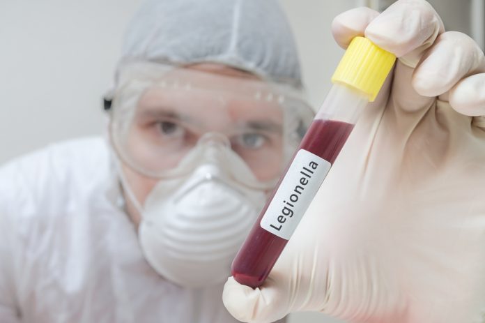 Onderzoeker in laboratorium houdt reageerbuis met legionella